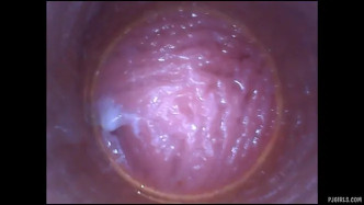 PJgirls Silvie DeLuxe   RAW Endoscopic Video   2015 08 23l J video