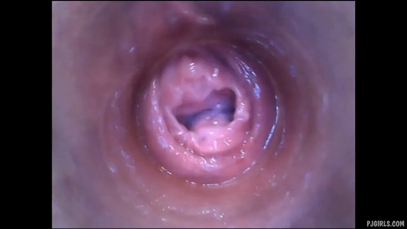 PJgirls Naomi   RAW Endoscopic Video   2015 10 11l J video